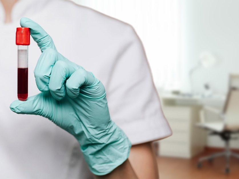 Hematologická ambulance - Oblastní nemocnice Příbram (areál II)