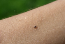 Nemoci z klíšťat prudce rostou, odborníci varují před druhou vlnou Nemoci z klíšťat prudce rostou, odborníci varují před druhou vlnou